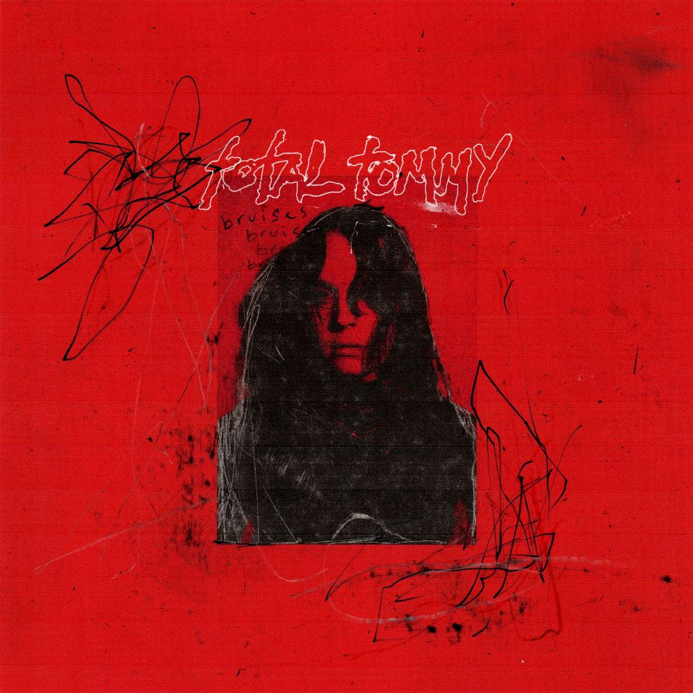 total tommy – bruises