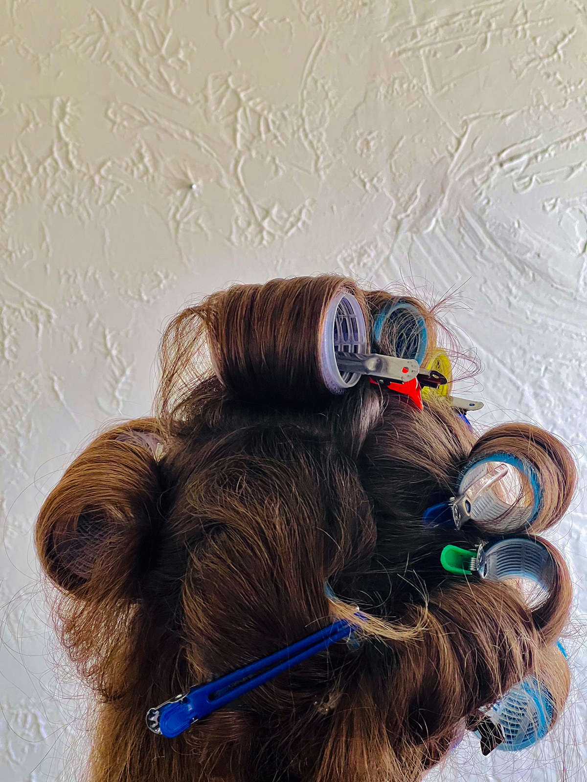 “The cut is starting to scab” by Photographer Dorian Tocker